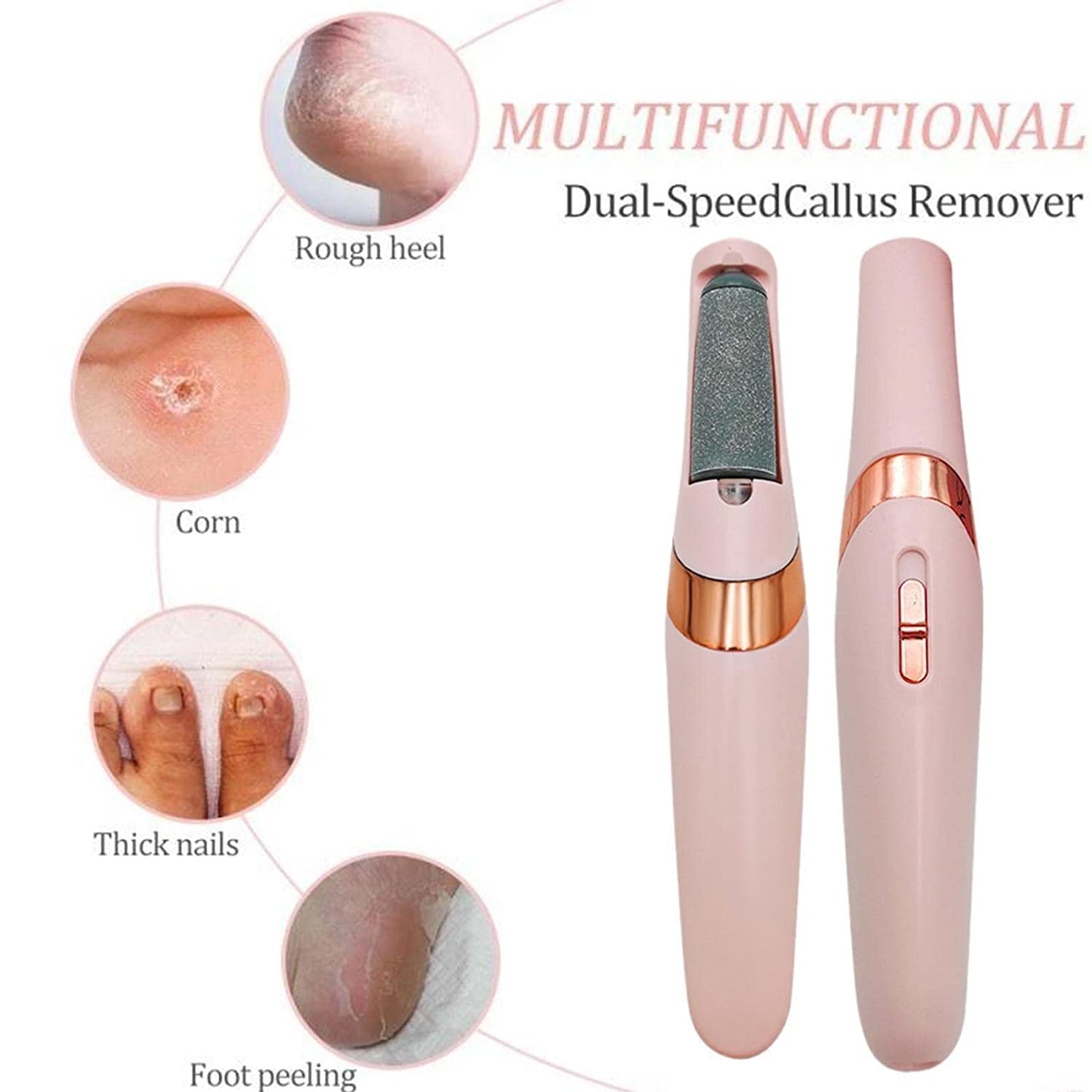 Callus Remover Rechargeable Pedicure Tool for Dead Skin |Foot Roller Callus Remover Hard and Dead Skin Remover |Feet Care Callus Remover | Pedicure for Hard Cracked Skin, Foot Scrubber Roller Callus Remover Rechargeable Pedicure Tool for Dead Skin |Foot Roller Callus Remover Hard and Dead Skin Remover |Feet Care Callus Remover | Pedicure for Hard Cracked Skin, Foot Scrubber Roller